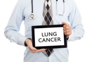 肺がんの治療とその治療費｜がん治療を知るシリーズ２