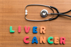 肝がんの治療とその治療費｜がん治療を知るシリーズ３